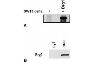 Western Blotting (WB) image for anti-SWI/SNF Related, Matrix Associated, Actin Dependent Regulator of Chromatin, Subfamily A, Member 4 (SMARCA4) (C-Term) antibody (ABIN614772) (SMARCA4 Antikörper  (C-Term))