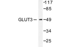 Image no. 1 for anti-Solute Carrier Family 2 (Facilitated Glucose Transporter), Member 3 (SLC2A3) antibody (ABIN265443) (SLC2A3 Antikörper)