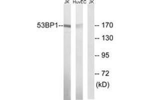 Western blot analysis of extracts from Jurkat/HuvEc cells, using 53BP1 (Ab-29) Antibody. (TP53BP1 Antikörper  (AA 14-63))