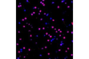 Immunofluorescence of paraffin embedded human brain using ZNF682 (ABIN7076270) at dilution of 1:400 (400x lens) (ZNF682 Antikörper)