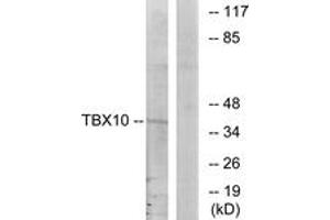 Western Blotting (WB) image for anti-T-Box 10 (TBX10) (AA 261-310) antibody (ABIN2889341) (T-Box 10 Antikörper  (AA 261-310))