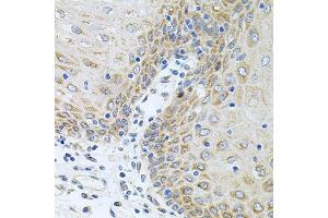 Immunohistochemistry of paraffin-embedded human esophagus using CPM antibody (ABIN6128978, ABIN6138956, ABIN6138957 and ABIN6222238) at dilution of 1:100 (40x lens). (CPM Antikörper  (AA 204-443))