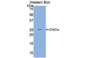 Detection of Recombinant ANGPTL8, Human using Polyclonal Antibody to Angiopoietin Like Protein 8 (ANGPTL8) (C19ORF80 Antikörper  (AA 24-196))