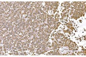 IHC analysis of SND1 using anti-SND1 antibody (ABIN7600525). (SND1 Antikörper  (AA 20-204))