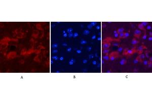 Immunofluorescence analysis of mouse brain tissue. (Ubiquitin Antikörper)