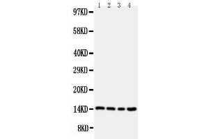Anti-Stefin B antibody, Western blotting Lane 1: A549 Cell Lysate Lane 2: A431 Cell Lysate Lane 3: COLO320 Cell Lysate Lane 4: HELA Cell Lysate (CSTB Antikörper  (Middle Region))