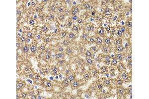 Immunohistochemistry of paraffin-embedded Rat liver using UBE2J2 Polyclonal Antibody at dilution of 1:100 (40x lens). (UBE2J2 Antikörper)