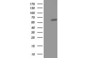 Western Blotting (WB) image for anti-Kelch-Like 2, Mayven (KLHL2) (AA 1-100), (AA 494-593) antibody (ABIN1490550) (KLHL2 Antikörper  (AA 1-100, AA 494-593))