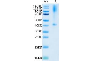 Biotinylated Human GPC3 on Tris-Bis PAGE under reduced condition. (Glypican 3 Protein (GPC3) (AA 25-559) (His-Avi Tag,Biotin))