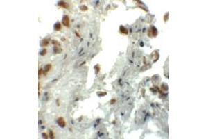 Immunohistochemistry (IHC) image for anti-Enhancer of Zeste Homolog 1 (EZH1) (N-Term) antibody (ABIN1031377) (EZH1 Antikörper  (N-Term))
