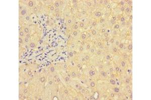 Immunohistochemistry (IHC) image for anti-UDP-Gal:betaGlcNAc beta 1,4- Galactosyltransferase, Polypeptide 5 (B4GALT5) (AA 101-388) antibody (ABIN7145396)