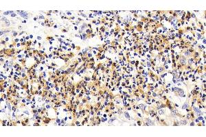 Immunohistochemistry (IHC) image for anti-Interleukin 7 Receptor (IL7R) (AA 173-260) antibody (ABIN7434320)