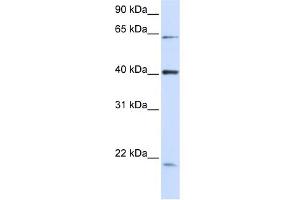 WB Suggested Anti-C19orf46 Antibody Titration:  0. (C19orf46 Antikörper  (N-Term))