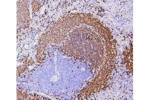IHC analysis of PAX5 using anti-PAX5 antibody (ABIN7600655).