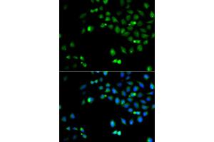 Immunofluorescence analysis of A549 cell using HOXA1 antibody. (HOXA1 Antikörper)