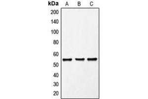 Western blot analysis of FRK expression in K562 (A), Molt4 (B), PC12 (C) whole cell lysates.