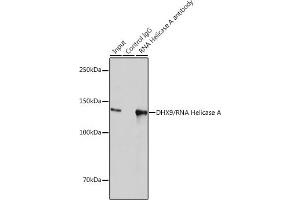 Immunoprecipitation (IP) image for anti-ATP-Dependent RNA Helicase A (DHX9) antibody (ABIN7265747)