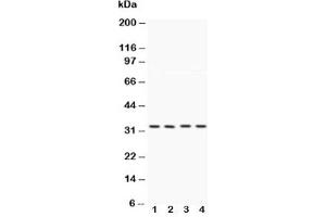 Western blot testing of Caspase-7 antibody and Lane 1:  HeLa;  2: MCF-7;  3: rat liver;  4: rat kidney