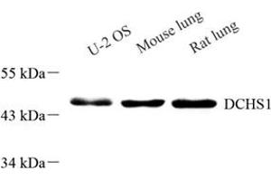 Western blot analysis of DCHS1 (ABIN7073689),at dilution of 1: 800 (DCHS1 Antikörper)
