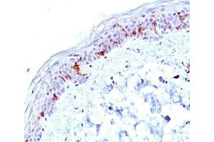 IHC testing of human human skin stained with CD1a antibody (O10). (CD1a Antikörper)