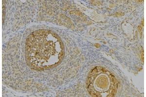 ABIN6277340 at 1/100 staining Human uterus tissue by IHC-P. (PGC Antikörper  (Internal Region))