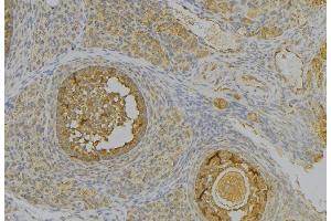 ABIN6277340 at 1/100 staining Human uterus tissue by IHC-P.