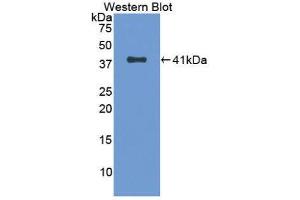 Western Blotting (WB) image for anti-Tryptase alpha/beta 1 (TPSAB1) (AA 161-262) antibody (ABIN1174171) (TPSAB1 Antikörper  (AA 161-262))