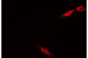 ABIN6274214 staining HeLa cells by IF/ICC. (MARK3 Antikörper  (N-Term))