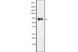 Western blot analysis of CHRNA4 using HuvEc whole cell lysates (CHRNA4 Antikörper  (N-Term))