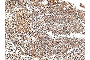 The image on the left is immunohistochemistry of paraffin-embedded Human tonsil tissue using ABIN7193077(XKR7 Antibody) at dilution 1/20, on the right is treated with synthetic peptide. (XKR7 Antikörper)