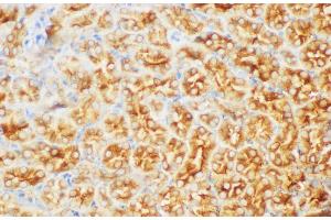 Immunohistochemistry of paraffin-embedded Mouse kidney using FGB Polycloanl Antibody at dilution of 1:200 (Fibrinogen beta Chain Antikörper)