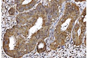 IHC analysis of AHA1/AHSA1 using anti-AHA1/AHSA1 antibody (ABIN7600708).