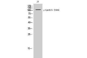 Western Blotting (WB) image for anti-EPHA2/5 (pTyr594) antibody (ABIN3180443) (EPHA2/5 (pTyr594) Antikörper)