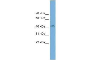 Western Blotting (WB) image for anti-UDP-Gal:betaGlcNAc beta 1,4- Galactosyltransferase, Polypeptide 3 (B4GALT3) (N-Term) antibody (ABIN2782250)