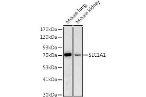 Western blot analysis of extracts of various cell lines, using (ABIN6131630, ABIN6147868, ABIN6147869 and ABIN6219899) at 1:1000 dilution. (SLC1A1 Antikörper  (AA 430-524))