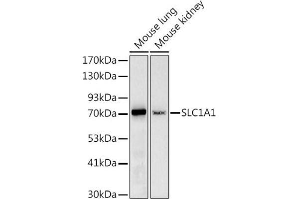 SLC1A1 Antikörper  (AA 430-524)