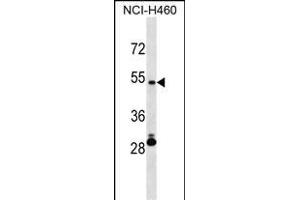 IRX6 Antibody (Center) (ABIN1538203 and ABIN2850242) western blot analysis in NCI- cell line lysates (35 μg/lane). (IRX6 Antikörper  (AA 260-288))