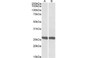 AP21292PU-N UCHL1 antibody staining of Mouse (A) and Rat (B) Brain lysate at 0. (UCHL1 Antikörper  (C-Term))