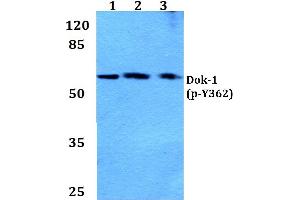 Western blot (WB) analysis of p-Dok-1 antibody at 1/500 dilution (DOK1 Antikörper  (pTyr362))
