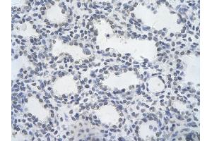 Immunohistochemistry (IHC) image for anti-Hematopoietically Expressed Homeobox (HHEX) (Middle Region) antibody (ABIN2777302)