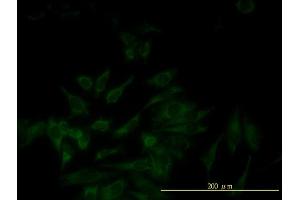 Immunofluorescence of monoclonal antibody to SERPINB5 on HeLa cell.