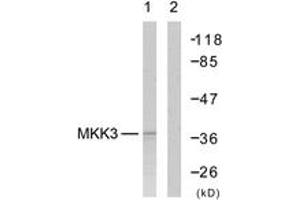 Western blot analysis of extracts from MDA-MB-435 cells, using MKK6 (Ab-207) Antibody. (MAP2K6 Antikörper  (AA 173-222))