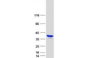 Western Blotting (WB) image for Coiled-Coil Domain Containing 101 (CCDC101) protein (Myc-DYKDDDDK Tag) (ABIN2713276)