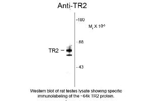 Western Blotting (WB) image for anti-Nuclear Receptor Subfamily 2, Group C, Member 1 (NR2C1) (N-Term) antibody (ABIN6657689)