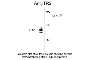 Western blot of Anti-Testicular Receptor 2 (TR2) (Rabbit) Antibody - 100-401-E45 Western Blot of Rabbit Anti-Testicular Receptor 2 (TR2) Antibody.