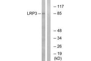 Western blot analysis of extracts from RAW264. (LRP3 Antikörper)