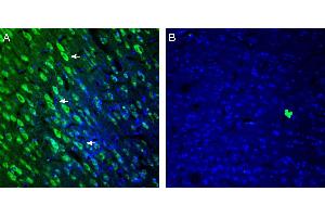 Expression of 5HT2A Receptor in rat cingulate cortex.