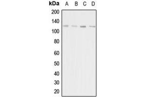 Western blot analysis of Adenylate Cyclase 1 expression in HeLa (A), HEK293T (B), mouse liver (C), rat kidney (D) whole cell lysates. (ADCY1 Antikörper  (Center))