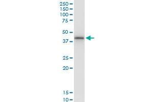 Immunoprecipitation of SNUPN transfected lysate using anti-SNUPN MaxPab rabbit polyclonal antibody and Protein A Magnetic Bead , and immunoblotted with SNUPN MaxPab mouse polyclonal antibody (B01) . (Snurportin 1 Antikörper  (AA 1-360))