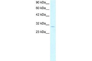 WB Suggested Anti-CDK4 Antibody Titration: 1. (CDK4 Antikörper  (C-Term))